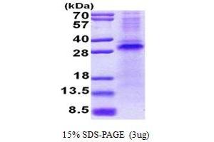 SDS-PAGE (SDS) image for Ring Finger and CHY Zinc Finger Domain Containing 1, E3 Ubiquitin Protein Ligase (RCHY1) (AA 1-261) protein (His tag) (ABIN5853062)
