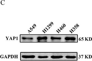 YAP1 expression levels in NSCLC tissues and NSCLC cell lines. (GAPDH antibody)