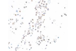 Immunocytochemistry (ICC) image for anti-Hepatitis A Virus Cellular Receptor 2 (TIM 3) (AA 22-201) antibody (ABIN7449550)
