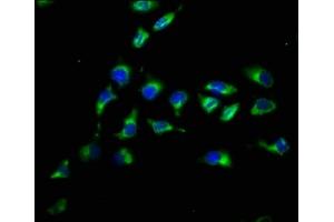 Immunofluorescence staining of A549 cells with ABIN7162659 at 1:200, counter-stained with DAPI.