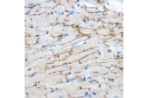 Immunohistochemistry of paraffin-embedded Mouse heart using Connexin 43 Rabbit pAb (ABIN6131701, ABIN6141098, ABIN6141099 and ABIN6215448) at dilution of 1:100 (40x lens). (Connexin 43/GJA1 antibody  (AA 233-382))