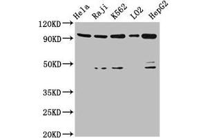 Western Blot Positive WB detected in: Hela whole cell lysate, Raji whole cell lysate, K562 whole cell lysate, LO2 whole cell lysate, HepG2 whole cell lysate All lanes: PROM1 antibody at 4. (CD133 antibody  (AA 508-792))