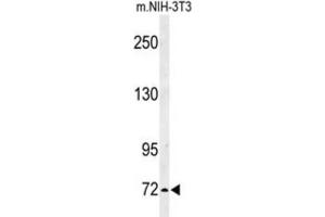 Western Blotting (WB) image for anti-Interleukin 1 Receptor Accessory Protein-Like 2 (IL1RAPL2) antibody (ABIN3003924) (IL1RAPL2 antibody)