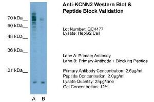 Host:  Rabbit  Target Name:  KCNN2  Sample Type:  HepG2  Lane A:  Primary Antibody  Lane B:  Primary Antibody + Blocking Peptide  Primary Antibody Concentration:  2. (KCNN2 antibody  (C-Term))