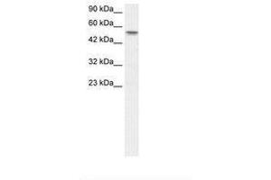 Image no. 1 for anti-Runt-Related Transcription Factor 1, Translocated To, 1 (Cyclin D-Related) (RUNX1T1) (AA 221-270) antibody (ABIN202771) (RUNX1T1 antibody  (AA 221-270))