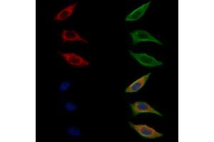 ABIN6262074 and ABIN6272312 staining Hela cells by IF/ICC. (GRAP antibody)