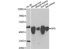 Western blot analysis of extracts of various cell lines, using HPD antibody (ABIN2563239) at 1:1000 dilution. (HPD antibody)
