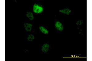 Immunofluorescence of monoclonal antibody to SF3B2 on HeLa cell. (SF3B2 antibody  (AA 592-645))