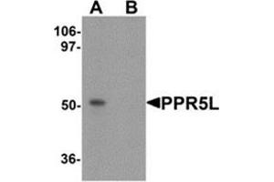 Western blot analysis of PRR5L in 3T3 cell lysate with PRR5L antibody at 1 μg/m in (A) the absence and (B) the presence of blocking peptide. (PRR5L antibody  (Center))