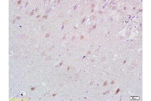 Formalin-fixed and paraffin embedded rat brain tissue labeled with Anti-Lingo-1 Polyclonal Antibody, Unconjugated  at 1:200 followed by conjugation to the secondary antibody and DAB staining (LINGO1 antibody  (AA 521-620))