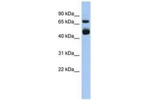 Image no. 1 for anti-Arachidonate 15-Lipoxygenase (ALOX15) (AA 539-588) antibody (ABIN6743958) (ALOX15 antibody  (AA 539-588))