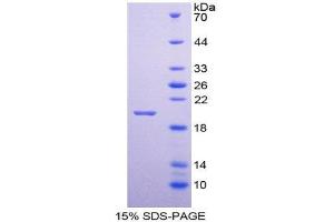 SDS-PAGE (SDS) image for Neuromedin U (NMU) (AA 38-174) protein (His tag) (ABIN1980881) (Neuromedin U Protein (NMU) (AA 38-174) (His tag))