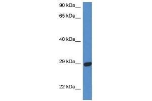 Western Blot showing STX2 antibody used at a concentration of 1 ug/ml against Fetal Heart Lysate