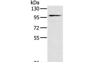 Western Blot analysis of Mouse heart tissue using KCNQ5 Polyclonal Antibody at dilution of 1:500 (KCNQ5 antibody)