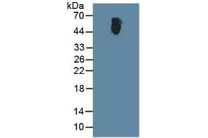Rabbit Capture antibody from the kit in WB with Positive Control:  Human serum. (ALT ELISA Kit)