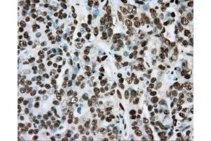 Immunohistochemical staining of paraffin-embedded colon tissue using anti-ARNT mouse monoclonal antibody.