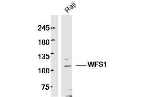Human Raji cells probed with WFS1 Polyclonal Antibody, unconjugated  at 1:300 overnight at 4°C followed by a conjugated secondary antibody at 1:10000 for 90 minutes at 37°C. (WFS1 antibody  (AA 791-890))