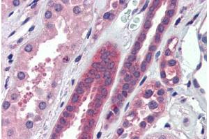 Human Kidney (formalin-fixed, paraffin-embedded) stained with ATP6V0A2 antibody ABIN462234 followed by biotinylated goat anti-rabbit IgG secondary antibody ABIN481713, alkaline phosphatase-streptavidin and chromogen. (ATP6V0A2 antibody  (AA 72-121))