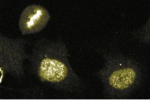 Immunofluorescence staining of human endothelial cells. (Aurora Kinase B antibody  (AA 2-124))