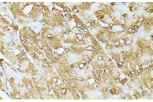 Immunohistochemistry of paraffin-embedded Rat heart using COX15 Polyclonal Antibody at dilution of 1:100 (40x lens). (COX15 antibody)