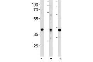 NeuroD1 antibody western blot analysis in 1) Y79 cell line, 2) mouse cerebellum and 3) rat brain tissue lysate.