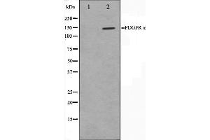 Western blot analysis on 293 cell lysate using PDGFRalpha Antibody,The lane on the left is treated with the antigen-specific peptide. (PDGFRA antibody  (Internal Region))