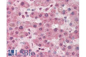 ABIN238663 (5µg/ml) staining of paraffin embedded Human Liver. (PC antibody  (Internal Region))