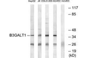 Western blot analysis of extracts from HuvEc/COLO/Jurkat/HepG2 cells, using B3GALT1 Antibody.