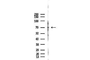 anti-ATP-Binding Cassette, Sub-Family F (GCN20), Member 2 (ABCF2) (Internal Region) antibody