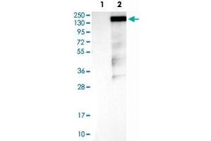 Western Blot analysis of Lane 1: negative control (vector only transfected HEK293T cell lysate) and Lane 2: over-expression lysate (co-expressed with a C-terminal myc-DDK tag in mammalian HEK293T cells) with RAPGEF1 polyclonal antibody . (GRF2 antibody)