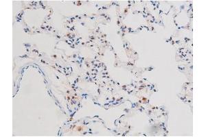 ABIN6267503 at 1/200 staining Rat lung tissue sections by IHC-P. (STAT3 antibody  (pSer727))