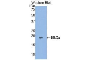 Western Blotting (WB) image for anti-Heat Shock 27kDa Protein 3 (HSPB3) (AA 1-150) antibody (ABIN3204389) (HSPB3 antibody  (AA 1-150))