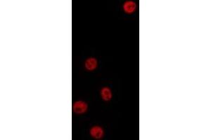 ABIN6277197 staining HepG2 by IF/ICC. (Histone 3 antibody  (H3K9me3))