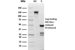 Topoisomerase II alpha antibody  (AA 1352-1493)