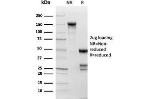 SDS-PAGE Analysis Purified Topoisomerase II alpha, Monoclonal Antibody (TOP2A/1361). (Topoisomerase II alpha antibody  (AA 1352-1493))