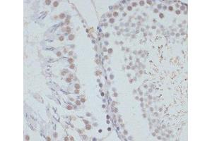 Immunohistochemistry (Paraffin-embedded Sections) (IHC (p)) image for anti-Mitogen-Activated Protein Kinase 3 (MAPK3) (pThr185), (pThr202), (pTyr187), (pTyr204) antibody (ABIN7265214)