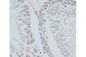 Immunohistochemistry of paraffin-embedded Rat testis using Phospho-ERK1(T202/Y204)/ ERK2(T185/Y187) Polyclonal Antibody at dilution of 1:100 (40x lens). (ERK1 antibody  (pThr185, pThr202, pTyr187, pTyr204))