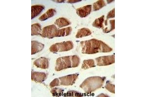 Immunohistochemistry (IHC) image for anti-CSRP2 Binding Protein (CSRP2BP) antibody (ABIN3003941) (CSRP2BP antibody)