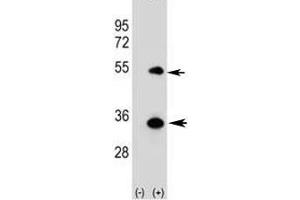 Western blot analysis of ATG5 antibody and 293 cell lysate (2 ug/lane) either nontransfected (Lane 1) or transiently transfected (2) with the human gene. (ATG5 antibody  (AA 1-30))