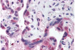 Human Placenta (formalin-fixed, paraffin-embedded) stained with TLR3 antibody ABIN214574 at 5 ug/ml followed by biotinylated goat anti-rabbit IgG secondary antibody ABIN481713, alkaline phosphatase-streptavidin and chromogen. (TLR3 antibody  (N-Term))