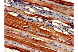 Immunohistochemistry of paraffin-embedded human skeletal muscle tissue using ABIN7152871 at dilution of 1:100 (Fibromodulin antibody  (AA 18-89))