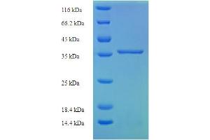 SDS-PAGE (SDS) image for Complement Component 8, gamma Polypeptide (C8G) (AA 21-202) protein (His-SUMO Tag) (ABIN5709171) (C8G Protein (AA 21-202) (His-SUMO Tag))