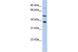 WB Suggested Anti-METTL2B Antibody Titration:  0. (METTL2B antibody  (N-Term))
