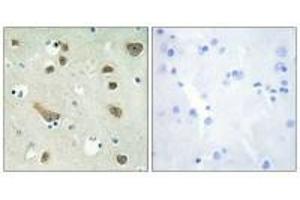 Immunohistochemistry analysis of paraffin-embedded human brain tissue using 14-3-3 γ antibody. (14-3-3 gamma antibody)