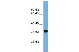 WB Suggested Anti-CBR1  Antibody Titration: 0.