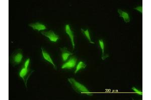 Immunofluorescence of monoclonal antibody to ZNF174 on HeLa cell. (ZNF174 antibody  (AA 1-234))