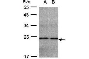 WB Image Sample(30 ug whole cell lysate) A: HeLa S3, B: Hep G2 , 12% SDS PAGE antibody diluted at 1:500 (NDUFB9 antibody  (Center))