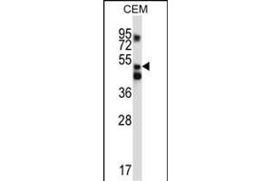 XPNPEP3 Antibody (C-term) (ABIN657127 and ABIN2846271) western blot analysis in CEM cell line lysates (35 μg/lane). (XPNPEP3 antibody  (C-Term))