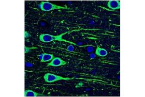 Image no. 3 for anti-Microtubule-Associated Protein tau (MAPT) (Thr231) antibody (ABIN197266)
