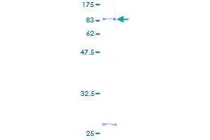 FGFRL1 Protein (AA 1-504) (GST tag)